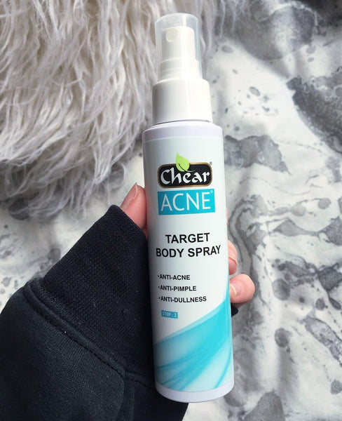 Chear Acne Target Body Spray | Skin lightening, moisturising & hair ...